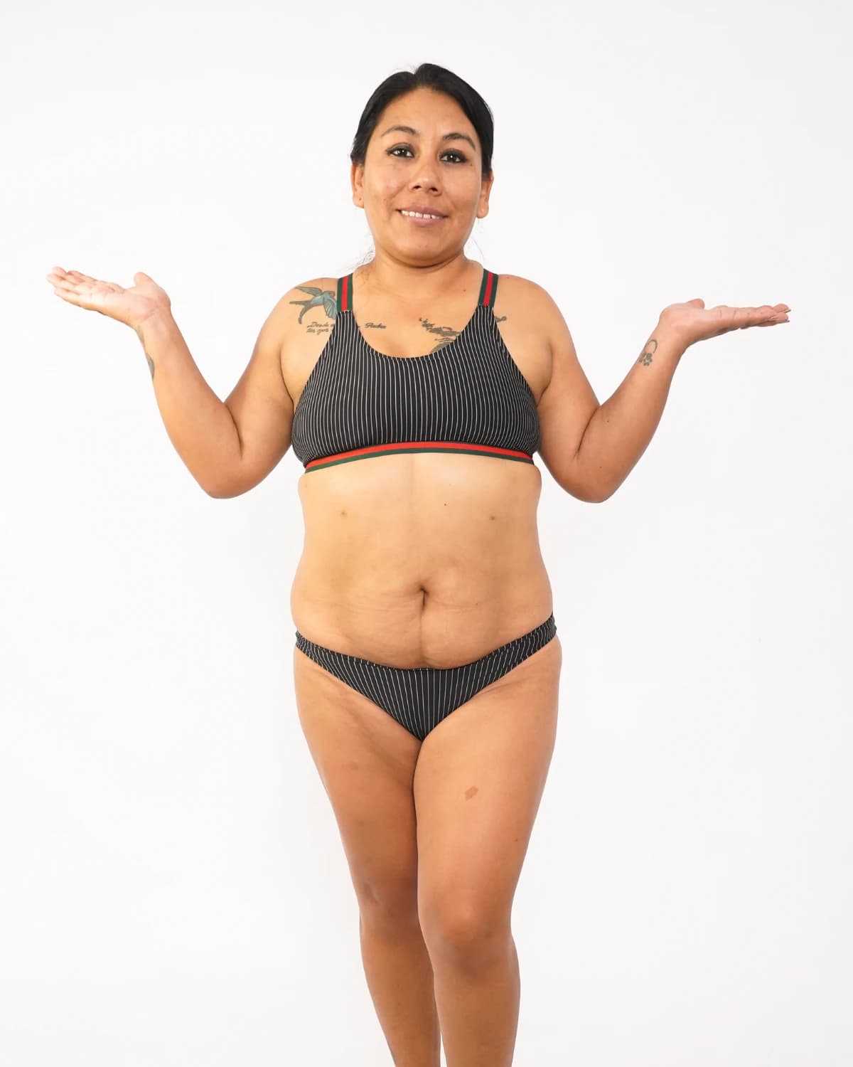 Mommy Makeover, case 1: front view before lipoabdominoplasty and breast augmentation, patient in a grey striped bikini on a light background