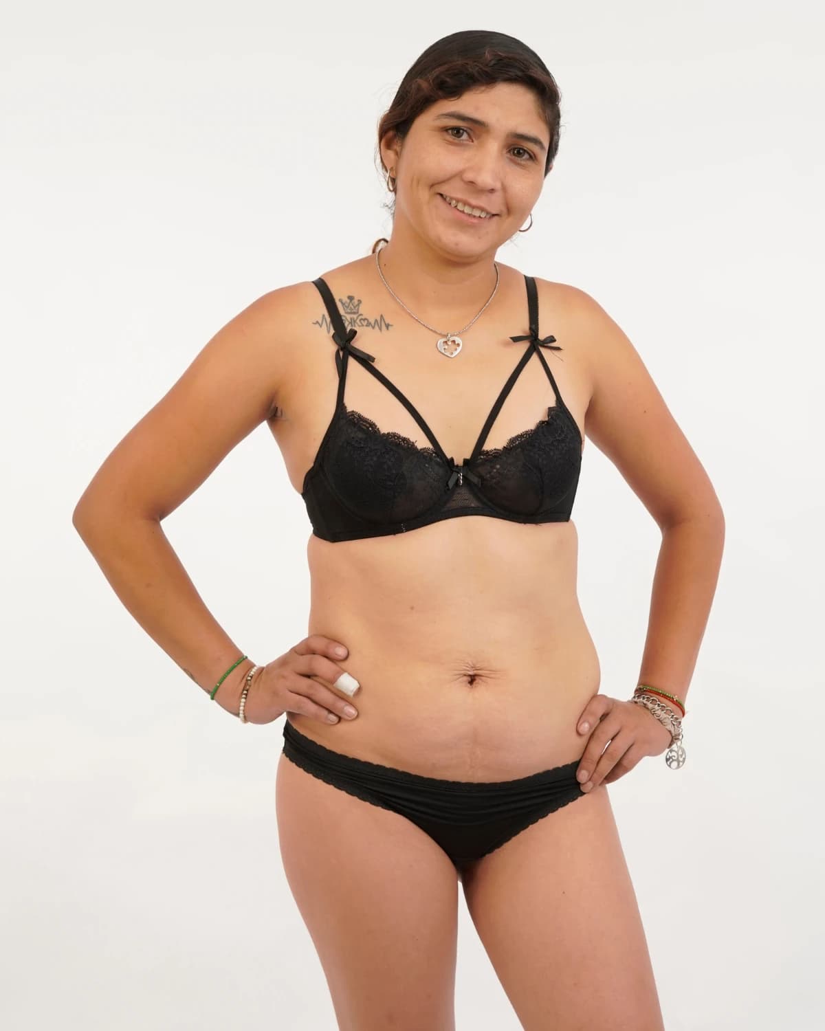 Mommy Makeover, case 3: front view of the abdomen and bust before surgery, patient in a black lace set on a light background