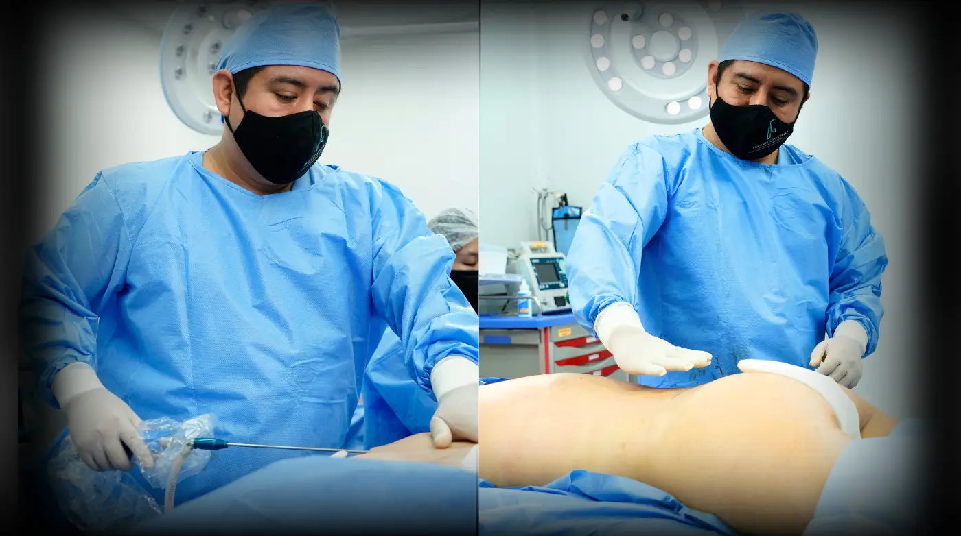Dr. Freddy Castillo realizando una cirugía de contorno corporal en su clínica de San Borja, Lima