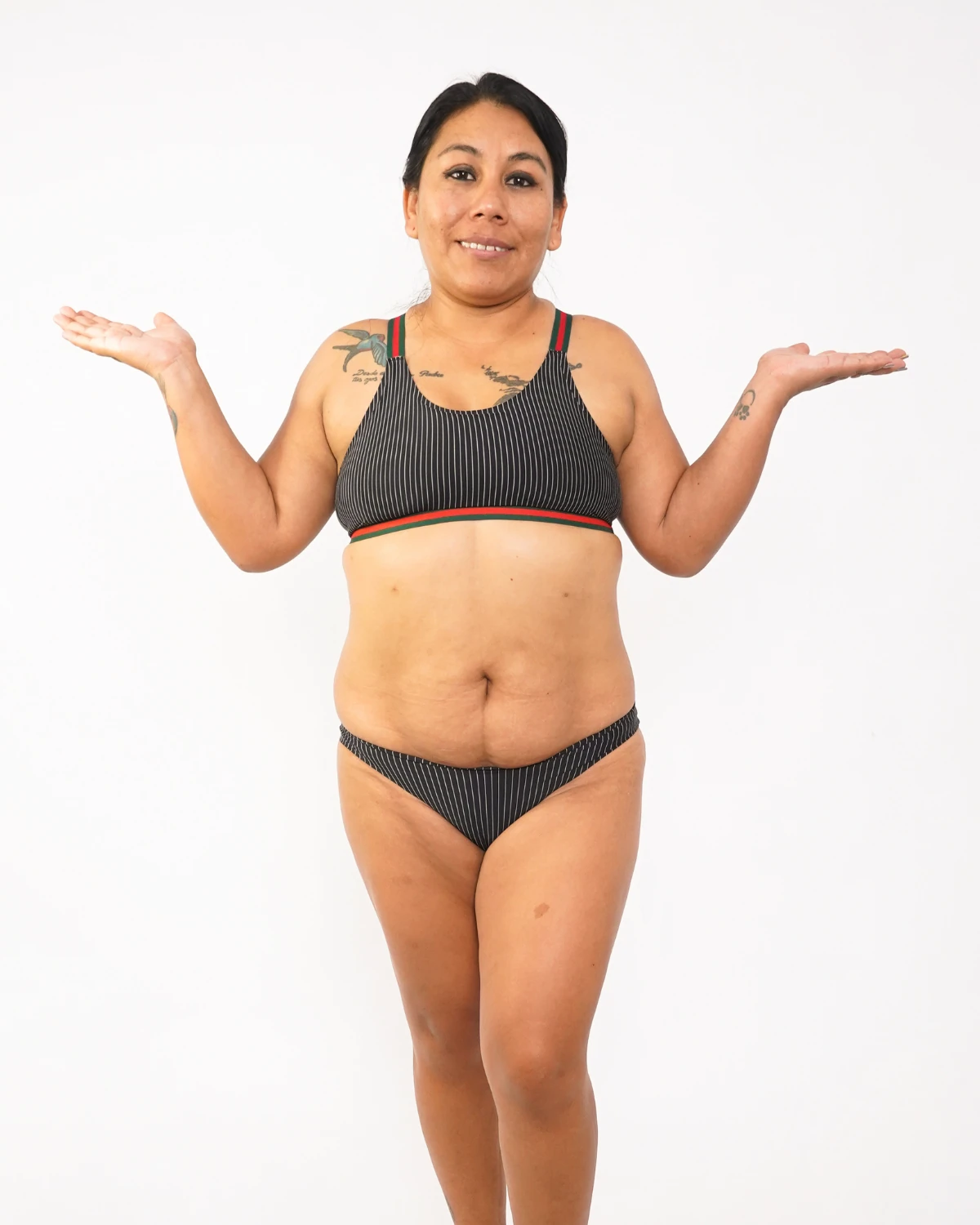 Mommy Makeover, caso 1: vista frontal antes de la lipoabdominoplastia y el aumento de mamas, paciente con bikini gris a rayas sobre fondo claro