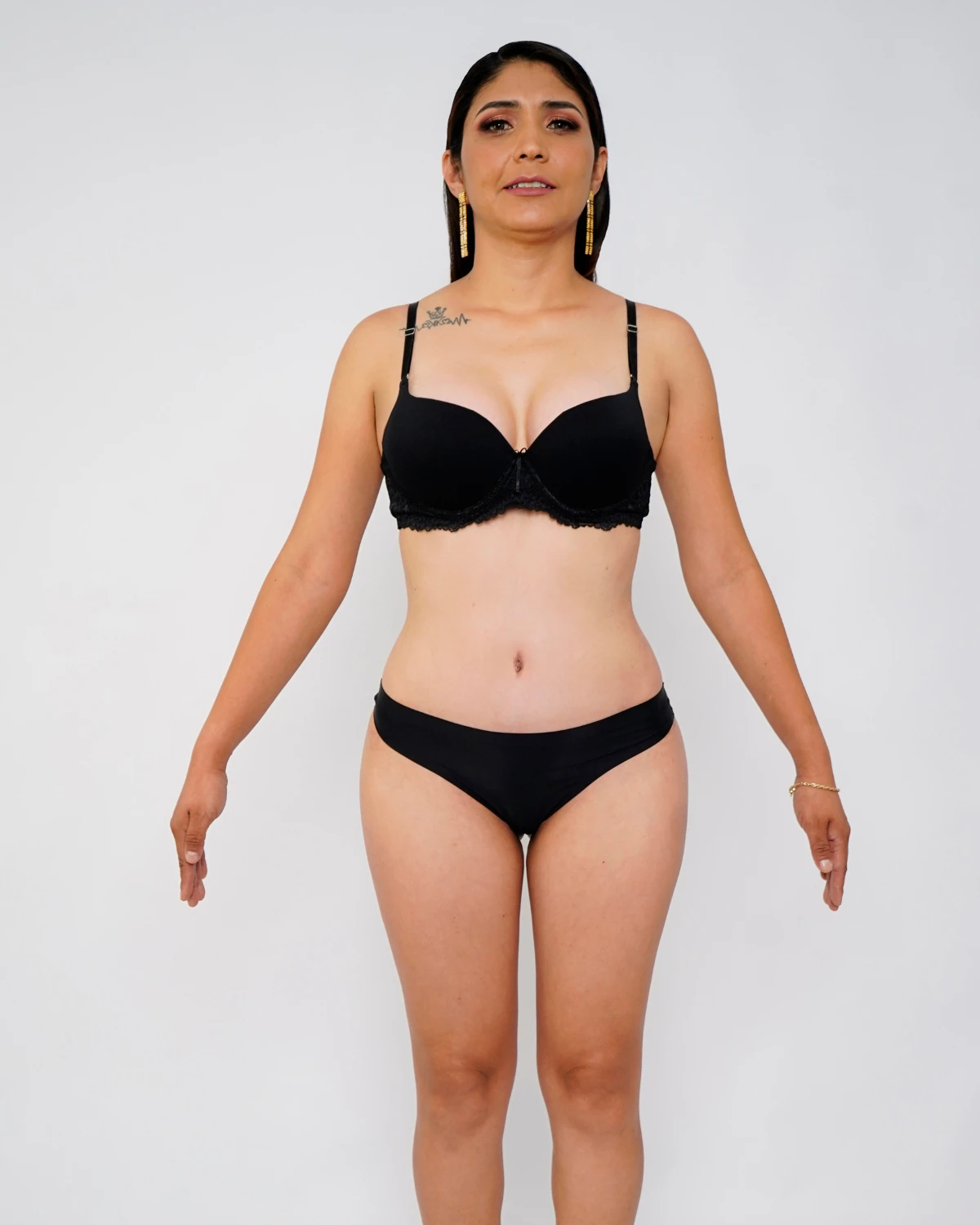 Mommy Makeover, caso 3: vista frontal de la misma paciente después de la cirugía, con conjunto negro liso sobre fondo claro