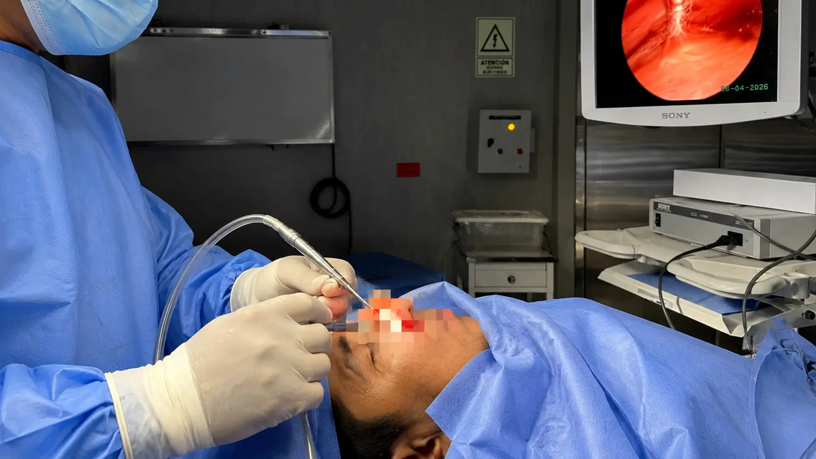 Dr. Freddy Castillo realizando una rinoplastia en su clínica de San Borja, Lima